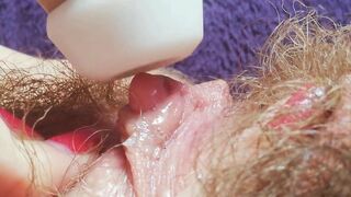 Big Clit Erection. MILF hairy pussy intense big clitor stimulation