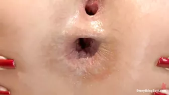 Hardcore ass stretching with rambone and anal gape retractor Hardcore ass stretching with rambone and anal gape retractor