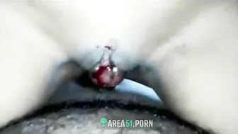 Virgin 18yo indian girl painful hymen tears during sex with brother Virgin 18yo indian girl painful hymen tears during sex with brother