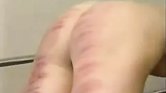 Spanking and Lupus - A Report Card