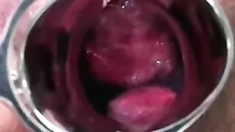 Japanese Doctor Accused of Assault After Striking Pregnant Patient