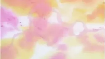 Hentai Patient Whips His Cock for Ultimate Pleasure